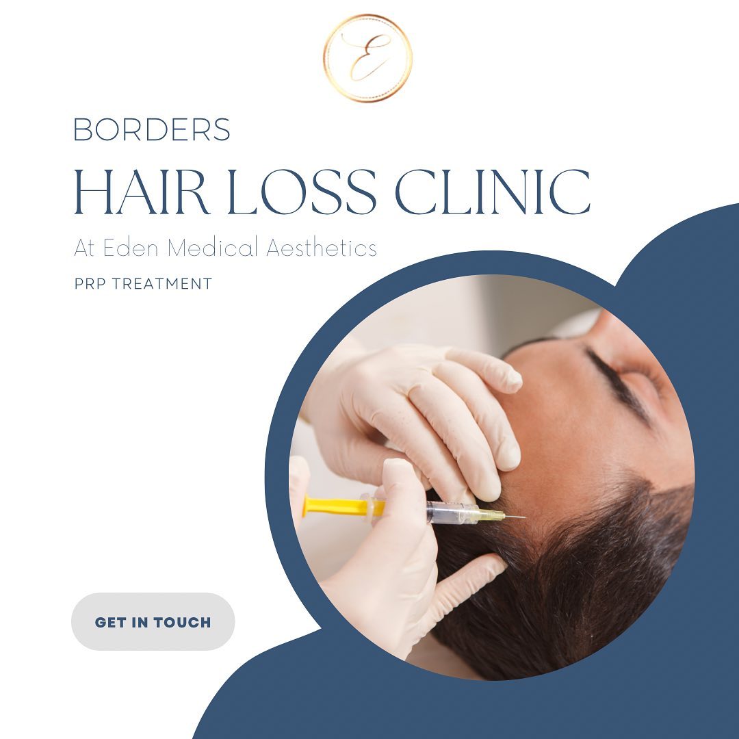PRP Hair Loss Treatment